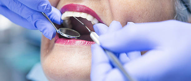 Teeth Whitening in CT